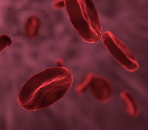 ANEMIA APLÁSTICA}