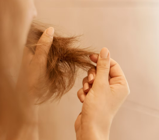 QUEDA DE CABELO PODE SER SINAL DE DEFICIÊNCIA DE FERRO? MÉDICO EXPLICA}