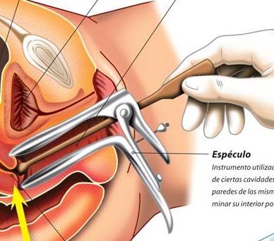 EXAME DE PAPANICOLAOU}