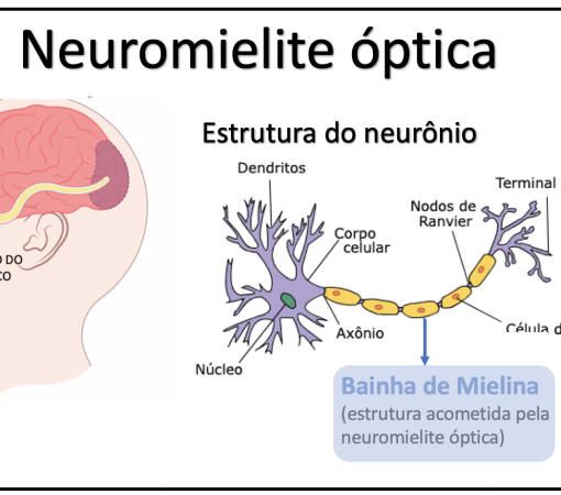 DOENÇA DO ESPECTRO DA NEUROMIELITE ÓPTICA}