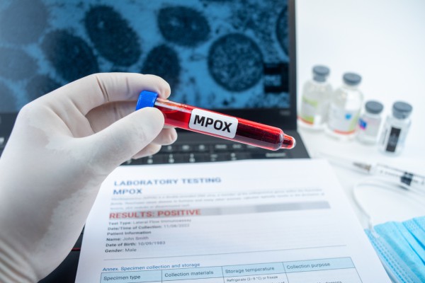ODONTOLOGIA TEM PAPEL ESTRATÉGICO NA IDENTIFICAÇÃO PRECOCE DA MPOX}