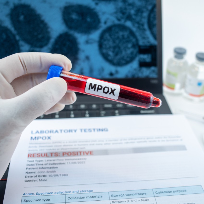 ODONTOLOGIA TEM PAPEL ESTRATÉGICO NA IDENTIFICAÇÃO PRECOCE DA MPOX