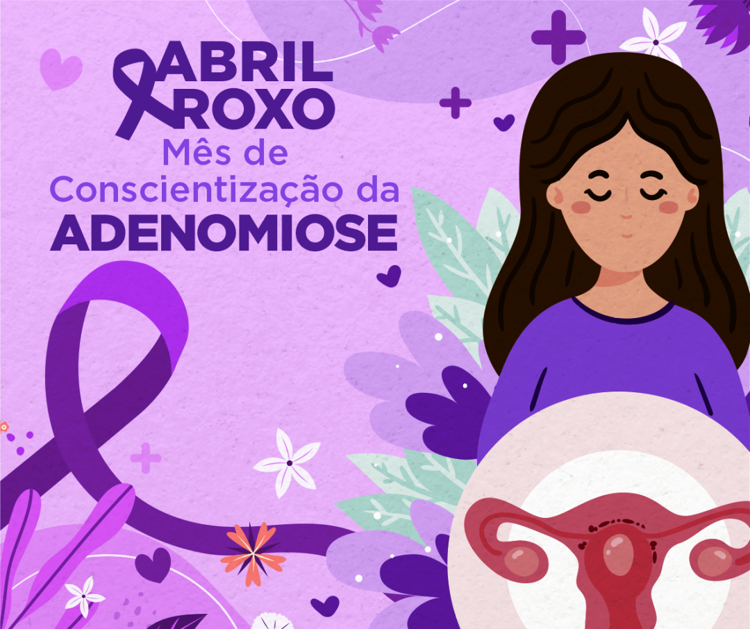 “ABRIL ROXO – MÊS DA CONSCIENTIZAÇÃO SOBRE A ADENOMIOSE”  - O QUE É?