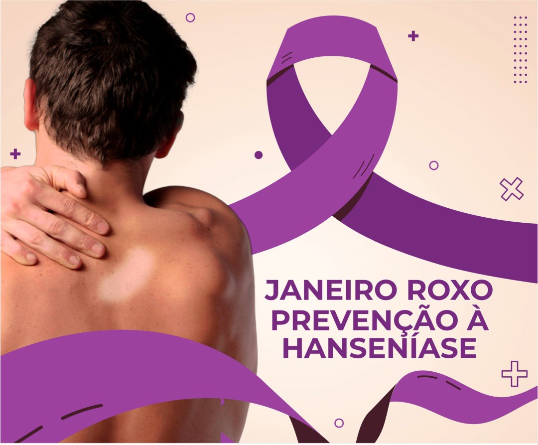 JANEIRO ROXO – MÊS DA PREVENÇÃO À HANSENÍASE