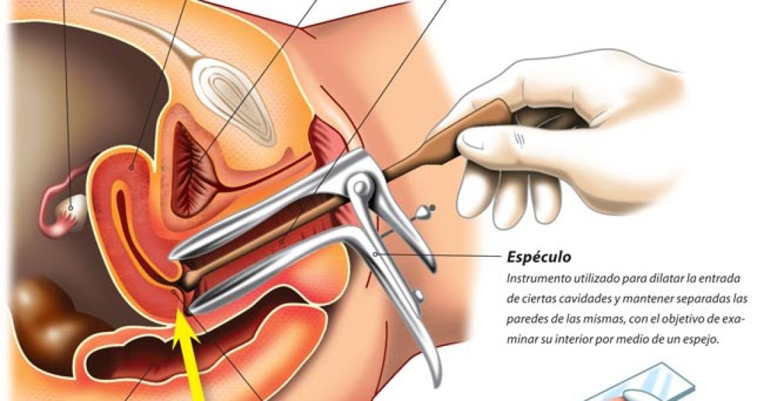 EXAME DE PAPANICOLAOU